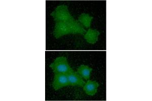 ICC/IF analysis of EIF5A in Balb/3T3 cells line, stained with DAPI (Blue) for nucleus staining and monoclonal anti-human EIF5A antibody (1:100) with goat anti-mouse IgG-Alexa fluor 488 conjugate (Green) (EIF5A Antikörper)