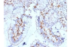 Immunohistochemistry (IHC) image for anti-Integrin, alpha E (Antigen CD103, Human Mucosal Lymphocyte Antigen 1, alpha Polypeptide) (ITGAE) antibody (ABIN6939806)
