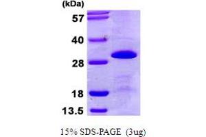 SDS-PAGE (SDS) image for Small Nuclear Ribonucleoprotein Polypeptide B (SNRPB2) (AA 1-225) protein (His tag) (ABIN667904)