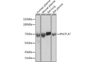 Western blot analysis of extracts of various cell lines, using tPA/tPA/PLAT Rabbit mAb (ABIN1678727, ABIN3018699, ABIN3018700 and ABIN7101650) at 1:1000 dilution. (PLAT Antikörper)