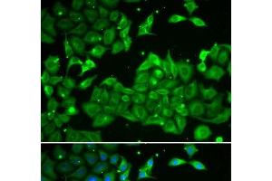 Immunofluorescence analysis of HeLa cells using ALDH3A1 Polyclonal Antibody (ALDH3A1 Antikörper)