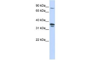 WB Suggested Anti-SLCO3A1 Antibody Titration:  0.