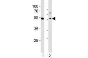 Western blot analysis of lysate from 1) human MCF-7 cell line and 2) mouse liver tissue tissue using Gata6 antibody at 1:1000. (GATA6 Antikörper  (C-Term))
