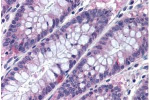 Human Colon (formalin-fixed, paraffin-embedded) stained with MTSS1 antibody ABIN290367 at 10 ug/ml followed by biotinylated goat anti-rabbit IgG secondary antibody ABIN481713, alkaline phosphatase-streptavidin and chromogen. (MTSS1 Antikörper  (AA 670-720))