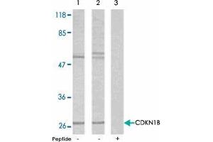Western blot analysis using CDKN1B polyclonal antibody  .