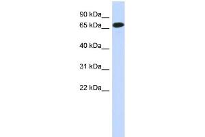 WB Suggested Anti-C1orf65 Antibody Titration: 0. (C1orf65 Antikörper  (N-Term))