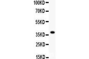 Anti- FOXO1A antibody, Western blotting All lanes: Anti FOXO1A at 0. (FOXO1 Antikörper  (AA 456-655))