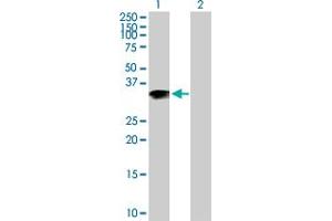 Western Blot analysis of ARL10 expression in transfected 293T cell line by ARL10 MaxPab polyclonal antibody. (ARL10 Antikörper  (AA 1-276))