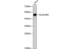 Western blot analysis of extracts of HeLa cells, using SLC9R2 antibody (ABIN7270487) at 1:1000 dilution. (SLC9A3R2 Antikörper  (AA 180-300))