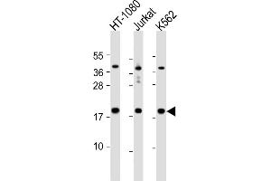 All lanes : Anti-NAT13 Antibody (C-term) at 1:1000 dilution Lane 1: HT-1080 whole cell lysate Lane 2: Jurkat whole cell lysate Lane 3: K562 whole cell lysate Lysates/proteins at 20 μg per lane. (NAA50 Antikörper  (C-Term))