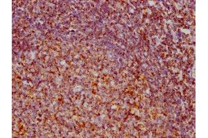 IHC image of ABIN7127868 diluted at 1:73. (Rekombinanter VDAC1 Antikörper)