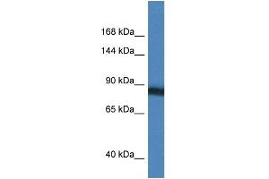 WB Suggested Anti-SEMA4D Antibody Titration: 1. (SEMA4D/CD100 Antikörper  (N-Term))
