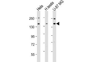 All lanes : Anti-USP47 Antibody (Center) at 1:2000 dilution Lane 1: Hela whole cell lysates Lane 2: human testis lysates Lane 3: U-87 MG whole cell lysates Lysates/proteins at 20 μg per lane. (USP47 Antikörper  (AA 588-620))