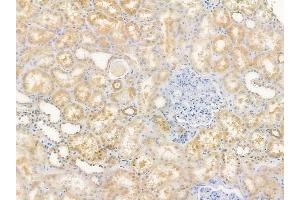 anti-Major Histocompatibility Complex, Class II, DM beta (HLA-DMB) (C-Term) antibody