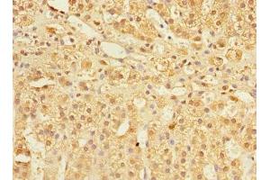 Immunohistochemistry of paraffin-embedded human adrenal gland tissue using ABIN7148298 at dilution of 1:100 (COMMD1 Antikörper  (AA 1-190))