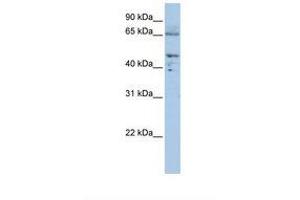 Image no. 1 for anti-Dihydrolipoyl Transacetylase (DLAT) (AA 540-589) antibody (ABIN6738015) (DLAT Antikörper  (AA 540-589))