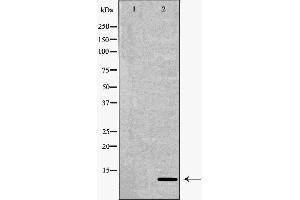 Western blot analysis of A375  lysate using S100B antibody. (S100B Antikörper  (C-Term))