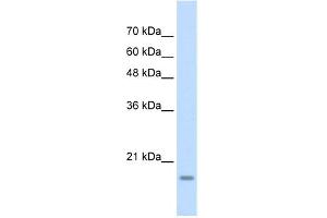 WB Suggested Anti-YAF2 Antibody Titration: 1. (YAF2 Antikörper  (Middle Region))