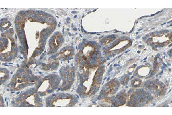 ARHGEF10 Antikörper  (Internal Region)