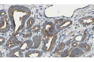 ABIN6275494 at 1/100 staining Human prostate tissue by IHC-P. (ARHGEF10 Antikörper  (Internal Region))