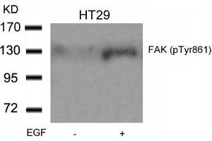 Western blot analysis of extracts from HT29 cells untreated or treated with EGF using FAK(Phospho-Tyr861) Antibody. (FAK Antikörper  (pTyr861))