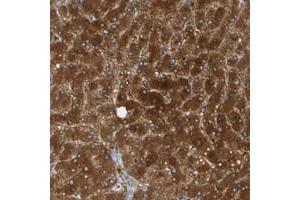 Immunohistochemical staining of human liver with PARP14 polyclonal antibody  shows strong cytoplasmic positivity in hepatocytes at 1:50-1:200 dilution. (PARP14 Antikörper)