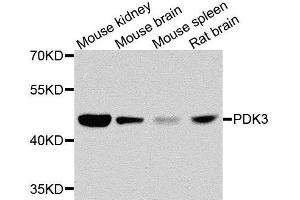 Western blot analysis of extracts of various cell lines, using PDK3 antibody. (PDK3 Antikörper  (AA 137-406))