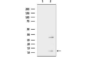Western blot analysis of lysates from P19 cells(UV treatment), using TI Antibody.