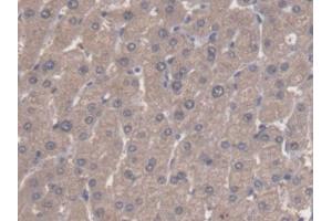 DAB staining on IHC-P; Samples: Human Liver Tissue (ALDH3A1 Antikörper  (AA 1-311))