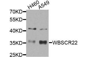Western blot analysis of extracts of various cell lines, using WBSCR22 antibody (ABIN5974419) at 1/1000 dilution. (WBSCR22 Antikörper)