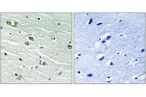 Immunohistochemistry analysis of paraffin-embedded human brain tissue, using MER/SKY (Ab-749/681) Antibody. (MER/SKY (AA 716-765) Antikörper)