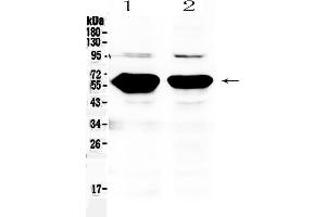 Western blot analysis of Alpha Amylase 1 using anti- Alpha Amylase 1 antibody .