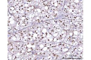 IHC analysis of RFX1 using anti-RFX1 antibody (ABIN7601842).