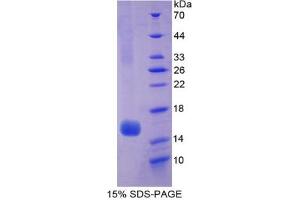 SDS-PAGE analysis of Human Hexosaminidase B beta Protein. (HEXB Protein)