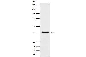 Western blot analysis of HDGF expression in A549 cell lysate.