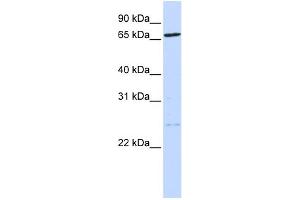 WB Suggested Anti-TLK1 Antibody Titration: 0. (TLK1 Antikörper  (N-Term))
