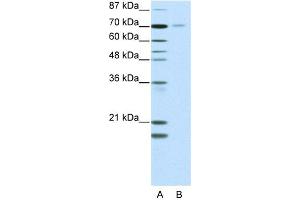 WB Suggested Anti-NR2C1 Antibody Titration:  2.