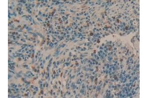 Immunohistochemistry (IHC) image for anti-Mucin 5AC, Oligomeric Mucus/gel-Forming (MUC5AC) antibody (ABIN7429022)
