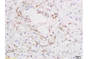 Immunohistochemistry (IHC) image for anti-Vascular Endothelial Growth Factor (VEGF) antibody (ABIN674829)