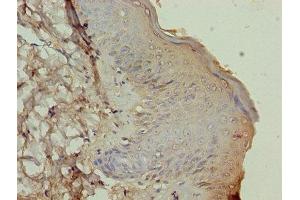 Immunohistochemistry of paraffin-embedded human skin tissue using ABIN7164023 at dilution of 1:100 (ATP12A Antikörper  (AA 171-306))