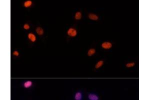 Immunofluorescence analysis of NIH-3T3 cells using PSME3 Polyclonal Antibody at dilution of 1:100 (40x lens). (PSME3 Antikörper)