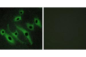 Peptide - +Immunofluorescence analysis of HeLa cells, using HER2 antibody. (ErbB2/Her2 Antikörper)