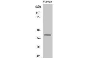 Western Blotting (WB) image for anti-X-Ray Repair Complementing Defective Repair in Chinese Hamster Cells 4 (XRCC4) (C-Term) antibody (ABIN3177959) (XRCC4 Antikörper  (C-Term))