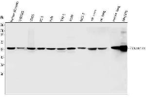 Western blot analysis of Vimentin using anti-Vimentin antibody (ABIN3042344).