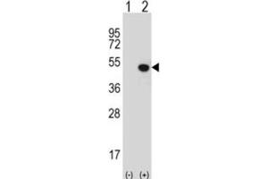Western Blotting (WB) image for anti-Jumonji Domain Containing 5 (JMJD5) antibody (ABIN2995955) (JMJD5 Antikörper)