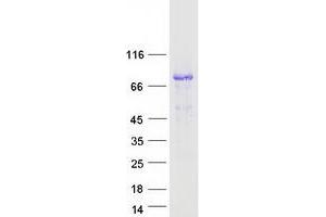 Western Blotting (WB) image for Dystrophia Myotonica-Protein Kinase (DMPK) (Transcript Variant 2) protein (Myc-DYKDDDDK Tag) (ABIN2719534)
