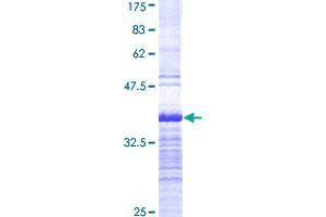 Image no. 1 for Zinc finger protein ubi-d4 (DPF2) (AA 56-155) protein (GST tag) (ABIN1351925) (DPF2 Protein (AA 56-155) (GST tag))