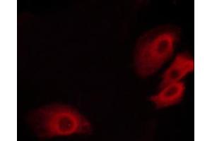 ABIN6267402 staining Jurkat cells by ICC/IF. (CD31 Antikörper  (pTyr713))