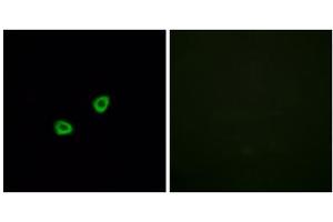 Immunofluorescence analysis of HUVEC cells, using OR1L6 antibody. (OR1L6 Antikörper  (Internal Region))