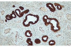 Immunohistochemistry (IHC) image for anti-Prostate Specific Antigen (PSA) (N-Term) antibody (ABIN7598882) (Prostate Specific Antigen Antikörper  (N-Term))